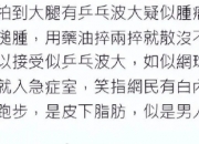 周润发否认患肿瘤：大家看到的那些小肉球其实是皮下脂肪