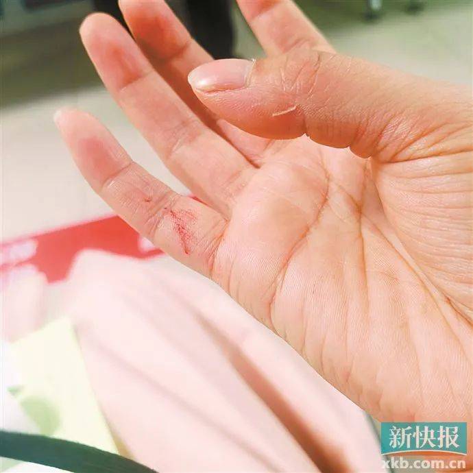 广州一业主入住新房不到两年，家中玻璃门爆裂伤人